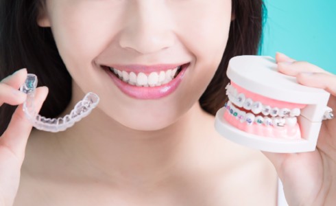 Invisalign Benefits, Surrey Dentist